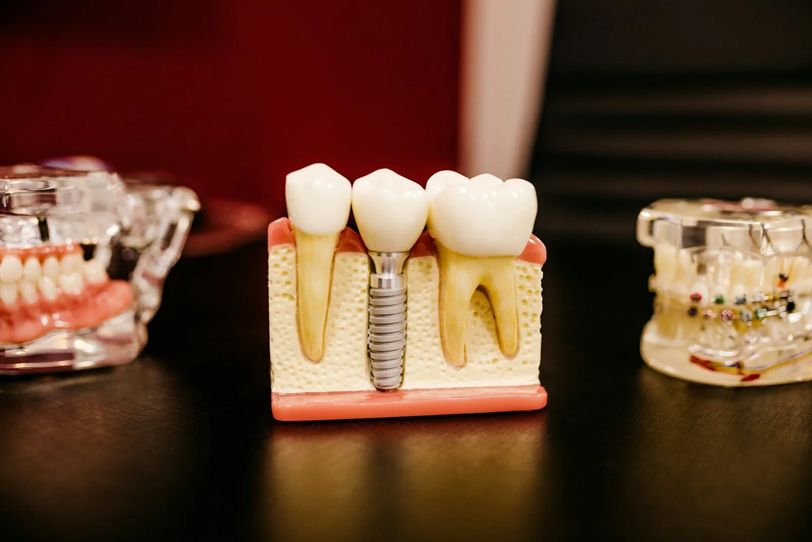 Model demonstrativ de implant dentar