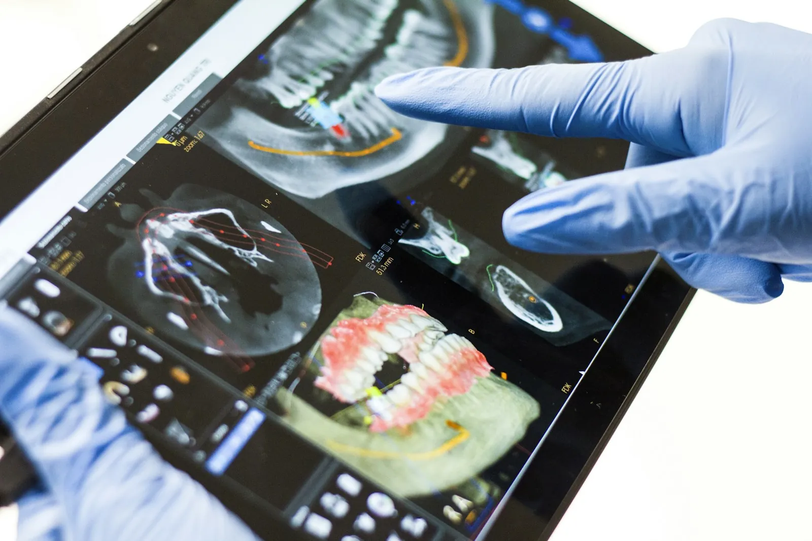 Medic dentist arătând o scanare dentară 3D pe tabletă