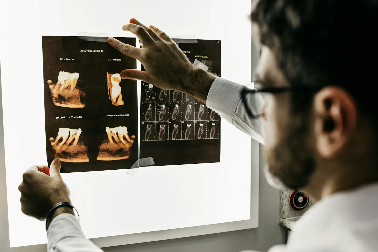 Medic analizând radiografii dentare pe negatoscop